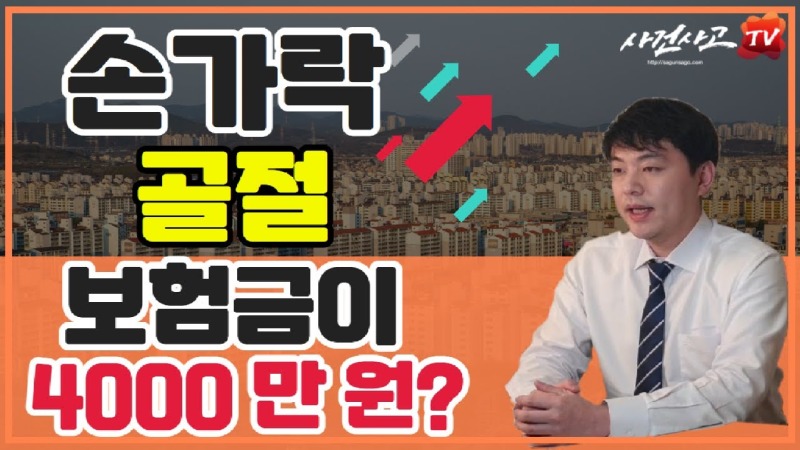 2021.04.03. [사건사고TV 148화] 손가락골절 후유장해 보험금 4000만원 보상사례 장해분류표 지관절 중수지관절 운동제한 검토 .jpg
