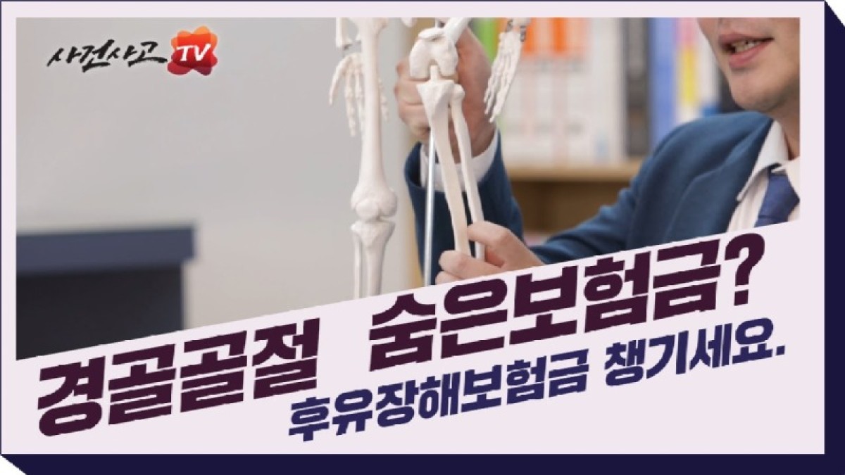 2021.04.30. [사건사고TV 174화] 경골골절 후유장해보험금 잘받는 방법 있나요 무릎과 발목 관절의 운동제한 진단 기준.jpg