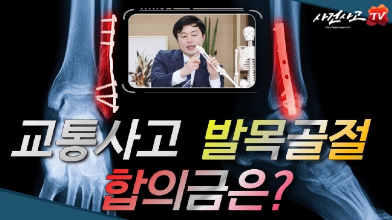 2021.05.14. [사건사고TV 188화] 교통사고 발목골절 합의금 산정방법 알려주세요 족관절 골절과 맥브라이드 후유장해 손해사정 실무.jpg
