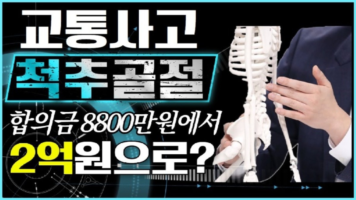 2021.05.07. [사건사고TV 181화] 교통사고 척추압박골절 합의금 산정방법 알려주세요 맥브라이드 장해평가와 소득·과실 손해사정 실무 가이드.jpg