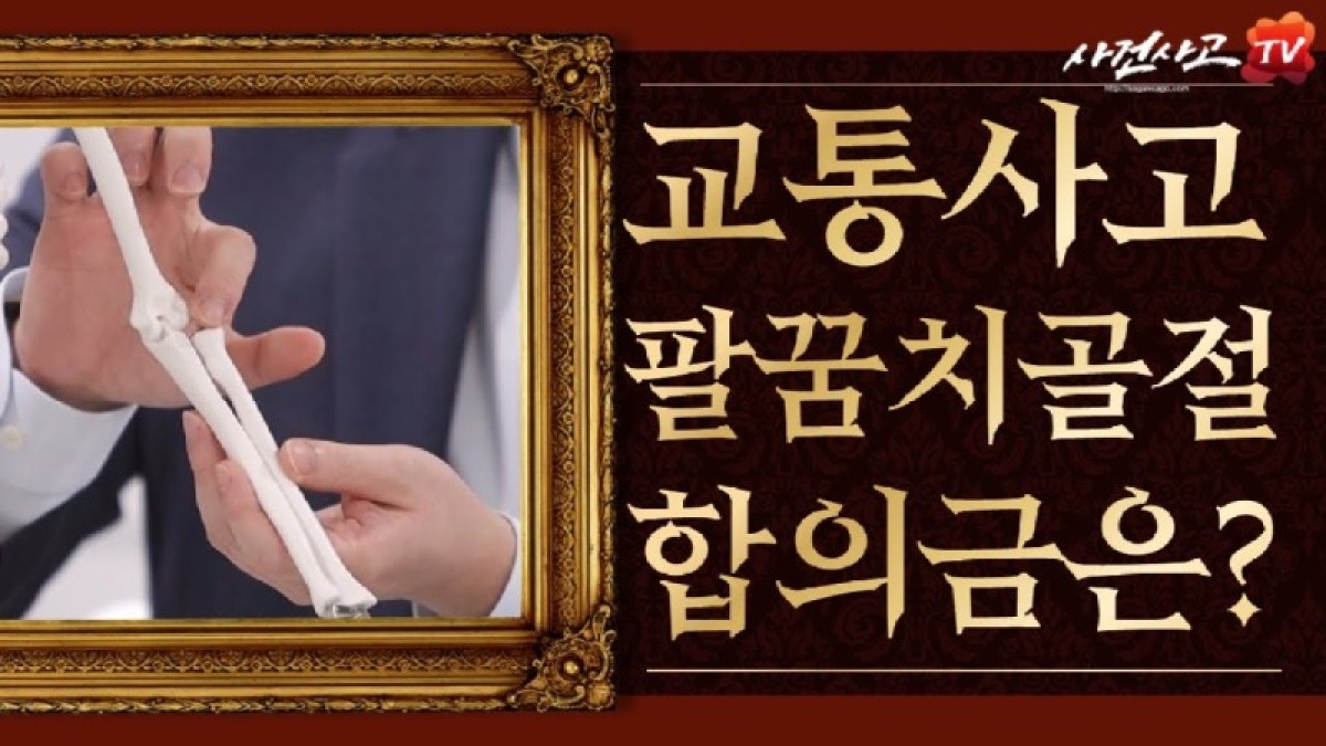 2021.05.11. [사건사고TV 185화] 교통사고 팔꿈치골절 합의금 산정방법 알려주세요 주관절 골절 후유장해 및 손해배상액 산정 실무 가이드.jpg